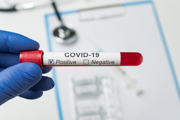 Naklejka premium Doctor holds tube with blood contaminated by coronavirus with label Covid-19. Positive analysis to 2019-nCoV