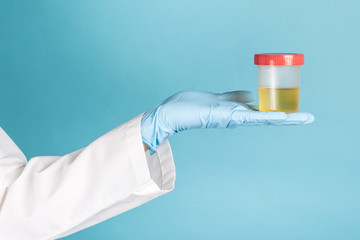 yellow urine in a plastic test jar in the hand of a blue gloved doctor