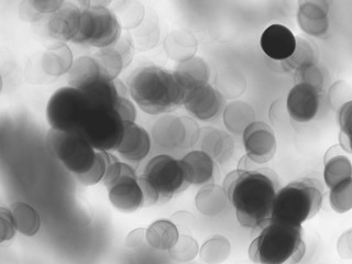 red blood cells flowing through microscope, concept virus cells