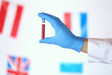 Coronavirus epidemic in the world. Coronavirus infection blood test.laboratory flask with blood and a hand in a blue medical glove on the background of the flags of the world.