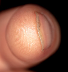 A finger on a man’s hand is isolated on a black background.