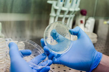 Growing bacteria to create CAR therapy - the novel method for leukemia, lymphoma therapy, and also could be tested for severe covid-19 tratment