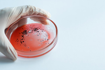 Research of viruses and bacteria, researcher holds a Petri dish with a sample.