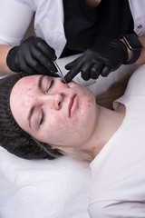 Procedure mechanical face cleaning in beauty salon. Young model getting cosmetic face skin care and treatments in cosmetologist. Acne treatment. Spa, cosmetology and wellness relaxation concept.
