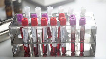 A row of human blood samples in a medical laboratory ready to be tested. healthcare background