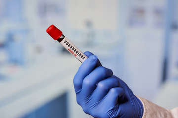 Naklejka premium A hand of a laboratory assistant in a blue disposable medical glove holding a positive coronavirus (COVID-19) blood test in the laboratory.