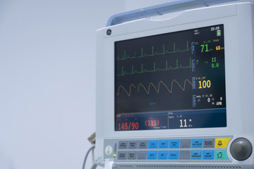 The Vital signs monitor in operating room in hospital. Vital signs monitor using for measure pulse...