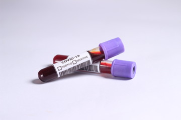 Close Up Photo, Simple Conceptual Hand Draw Sketch Vector, Glass Blood Covid-19 Test tube, without result