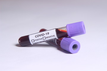 Close Up Photo, Simple Conceptual Hand Draw Sketch Vector, Glass Blood Covid-19 Test tube, without result