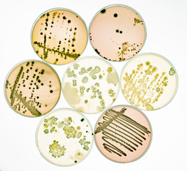 Growing Bacteria in Petri Dishes on agar gel Scientific experiment.