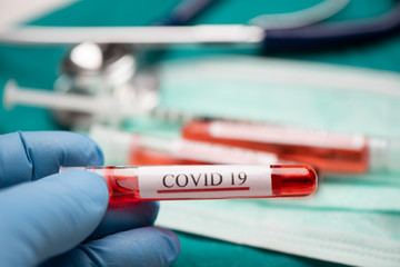 Doctor hands holding COVID 19 Coronavirus test blood.