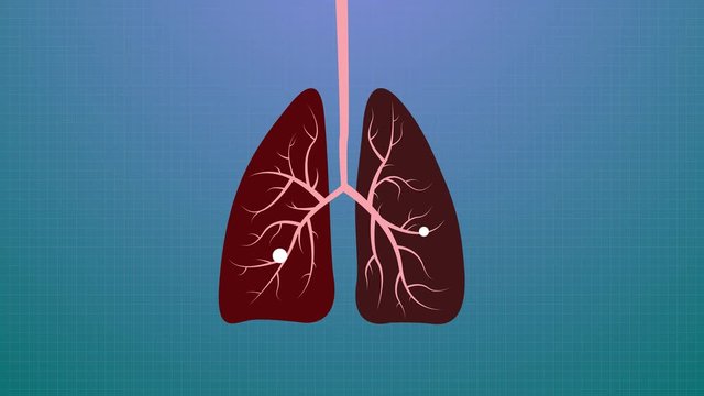 Animation of Covid-19 or Corona Virus in Human Lung and Respiratory System. The spread of the virus in human lungs. Recovery and treatment of the respiratory system. 4k video.