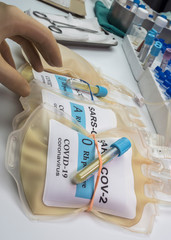 Plasma bag with antibodies from people cured of SARS-COV-2 Covid-19 prepared in a hospital, conceptual image