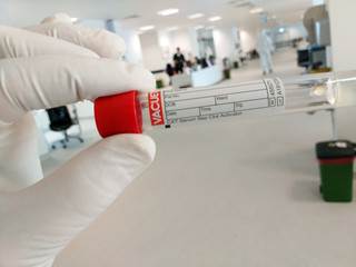 close the tube with the glove the hand that holds the blood in the background.in the background,...