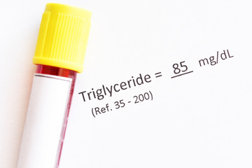 Blood sample with normal triglyceride test result