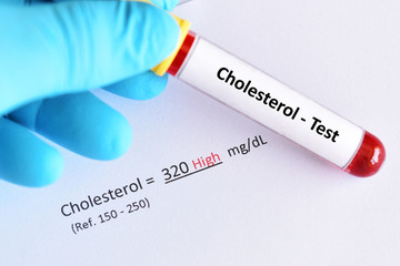 Blood sample tube with abnormal high cholesterol test result