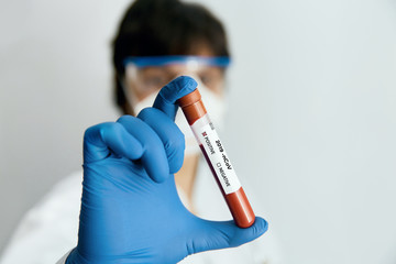 Obraz premium Coronavirus 2019-nCoV Blood Sample. Doctor scientist in protective gloves, mask and glasses holding test tube with blood for 2019-nCoV analyzing. Coronavirus blood test Concept. Vaccine research