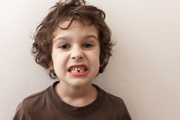 Charming curly boy smiles without tooth on white background. The boy lost the first milk tooth. Healthy teeth concept, dental clinic.