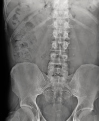x-ray contrast urography, medical diagnostics, urology