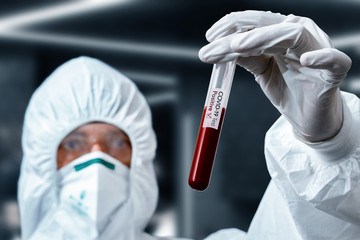 Concentrated scientist with test tube in hand