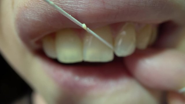 CU, macro view: young woman cleans healthy white teeth with floss at bright light on dark background close view