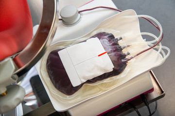 Blood transfusion. Red blood bag in laboratory. Blood donor at donation, transfusion.