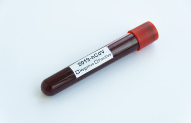 Isolated blood test of Coronavirus, Covid 19 on white background. Close up