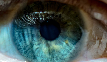 Eye