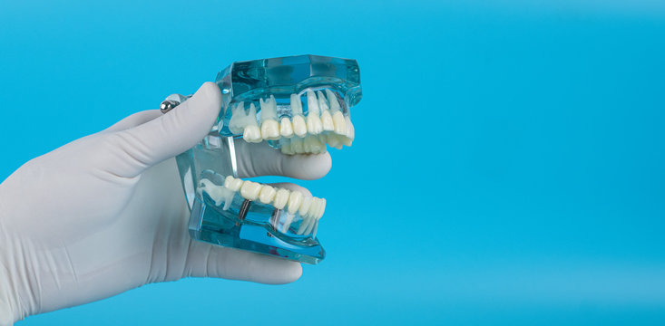 Cropped Hand Of Dentist Holding Dentures Against Blue Background