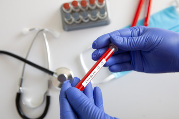 Coronavirus blood test concept. Doctor's hand in a medical glove holding a test tube with positive coronavirus blood over a laboratory desk. Coronavirus COVID-19. Pandemic.