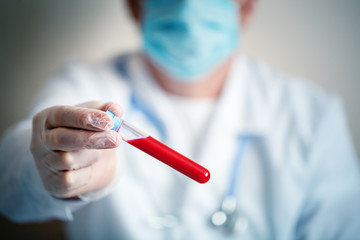 The epidemic of coronavirus. Hand of a doctor holding a bottle of blood sample.