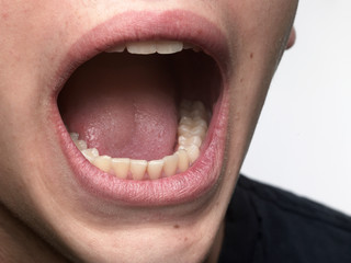 Boy with open mouth and healthy teeth, unrecognizable.