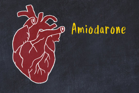 Learning cardio system concept. Chalk drawing of human heart and inscription Amiodarone