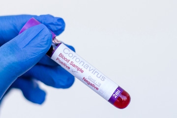 Fototapeta premium A gloved junior doctor holding a positive blood test result for coronavirus in Turkey