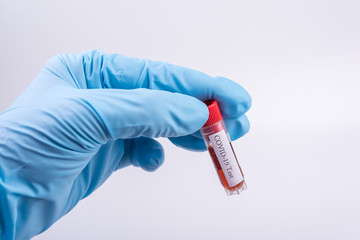 Serum blood with Coronavirus  COVID-19  in test tube in hand of scientist