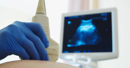 Close up of a pregnant woman having ultrasound scanning at the medical clinic. Ultrasound monitor...