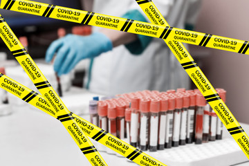 Coronavirus yellow warning tapes against doctor in blue disposable gloves, laboratory test tubes on...