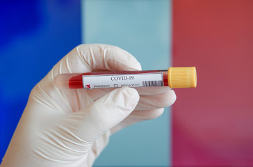 COVID-19 Pandemic Coronavirus concept ; Close-up of a Positive COVID-19 blood test sample tube with Flag of France at background. Blood testing for diagnosis new Corona virus infection.