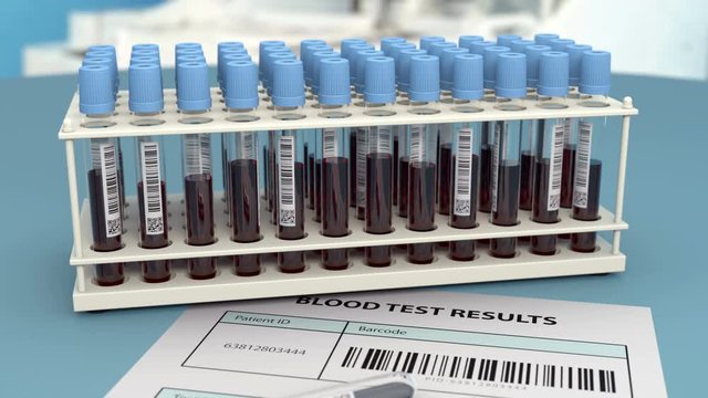 Blood samples in test tubes in the scientific research laboratory. One test tube is on the sheet with result of analysis. Biochemical test shows that blood is infected and urgent vaccination needed.