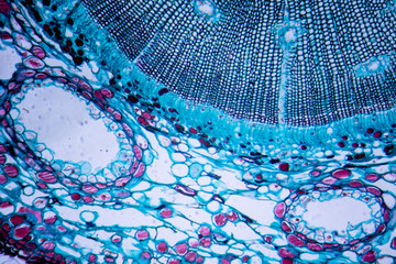 Microscopic image of Pine Stem (cross-section)