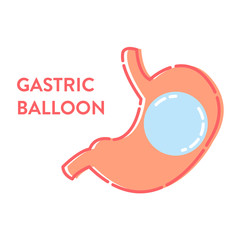 Gastric balloon non surgical weight loss procedure in stomach. Medical concept. Human body organ anatomy and health care. Vector illustration in flat style.