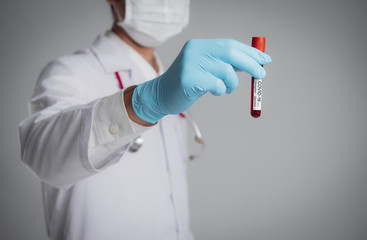 Hand of a doctor holding test tube with blood for Covid-19 (coronavirus) analyzing. Laboratory testing patient’s blood
