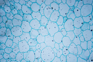 Microscopic image of sunflower stem (cross-section)