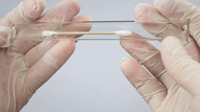 A virologist puts a cotton swab into a test tube to examine a smear from the lungs. A doctor takes a sample from the throat for a coronavirus test. Laboratory studies of bacteriological weapons