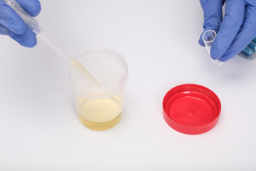 A doctor, lab technician in blue gloves holding urine sample in a plastic container, urinalysis and...