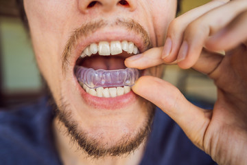 Man placing a bite plate in his mouth to protect his teeth at night from grinding caused by...