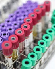 Blood collection tubes in a hospital lab