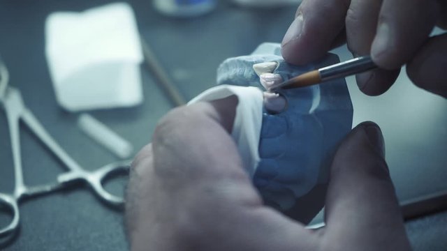 a dental technician takes a special paste and covers the tooth implant