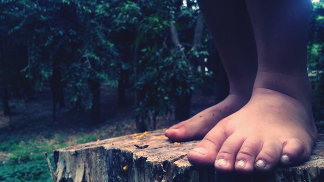 Close-up Of Bruised Feet