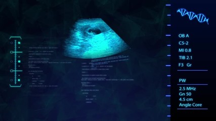 Ultrasound ,Sonogram Procedure to baby or fetus development and pregnancy. 
Futuristic Baby Ultrasound with blue tone Analyse HUD screen.
 - Powered by Adobe